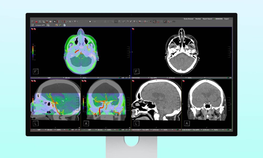Apple Studio Display XDR DICOM Medical Imaging Hero