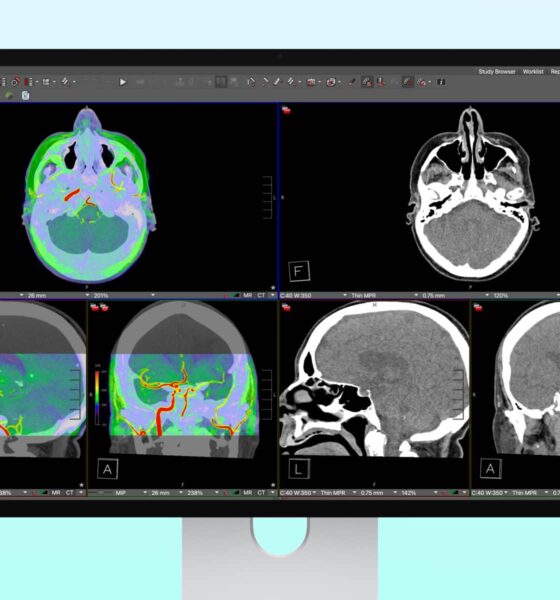 Apple Studio Display XDR DICOM Medical Imaging Hero