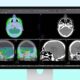 Apple Studio Display XDR DICOM Medical Imaging Hero