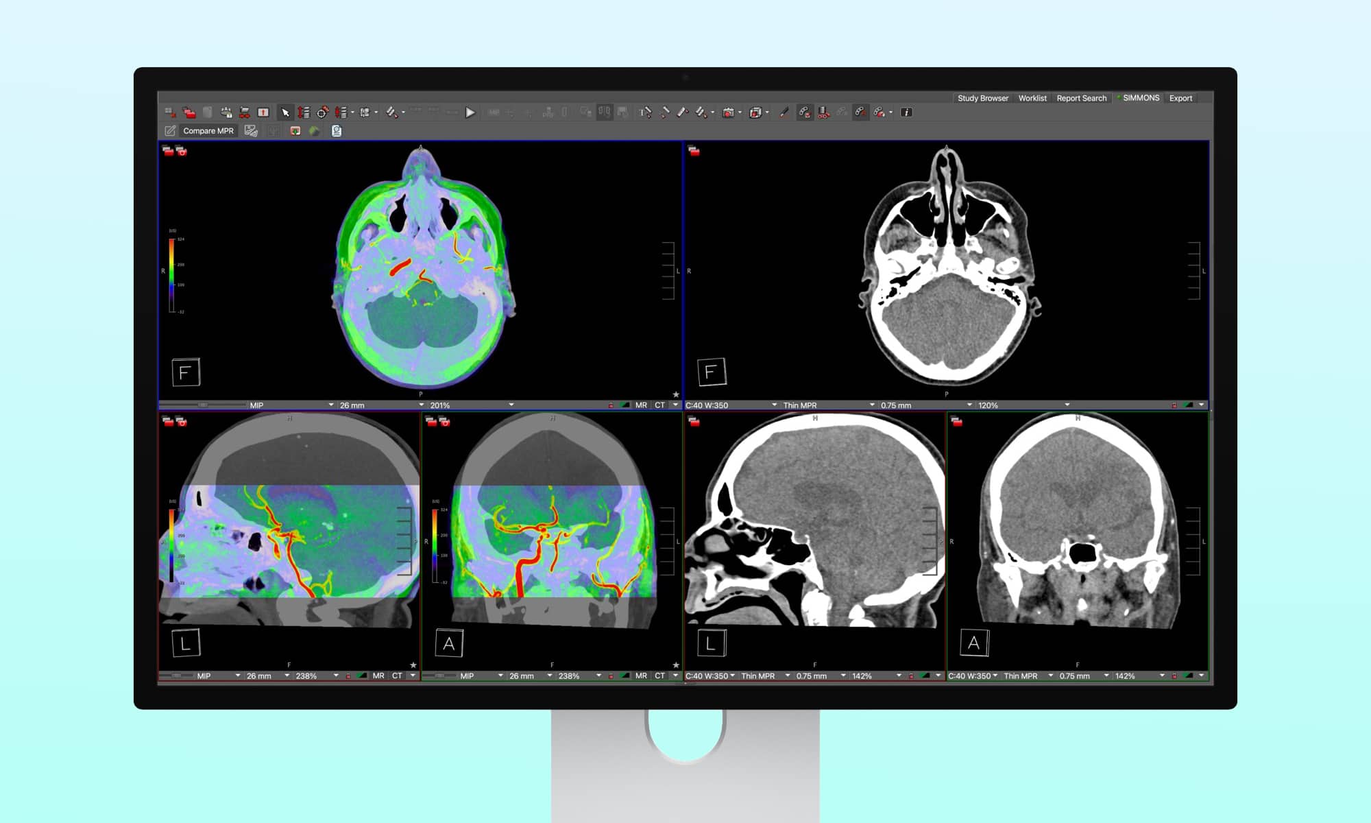 Apple Studio Display XDR DICOM Medical Imaging Hero