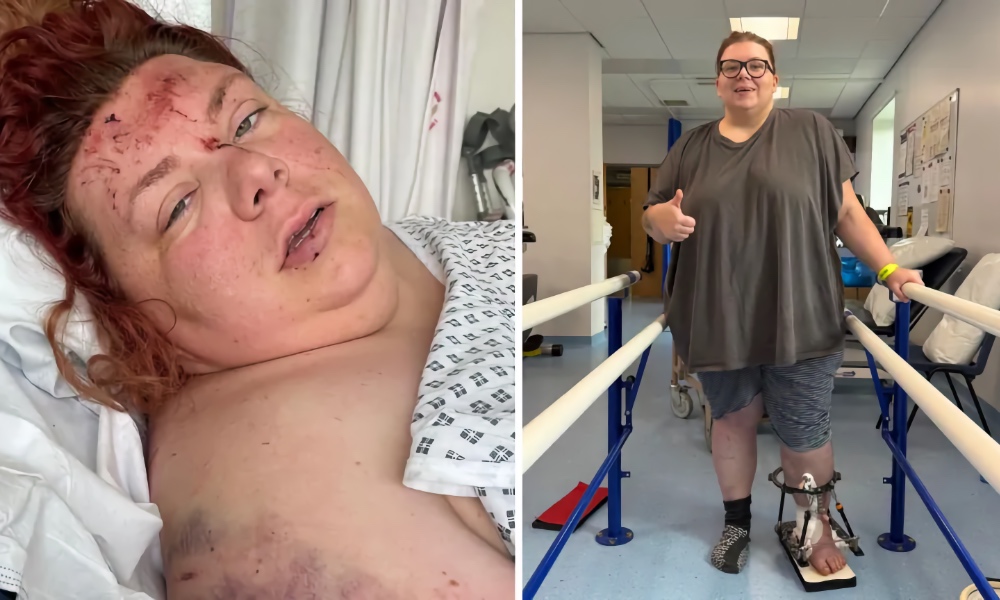 Natalia Sidorska survived a car crash which left her hospitalised for four months