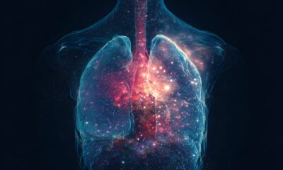 Insilico Medicine advances AI drug for IPF to Phase III trials