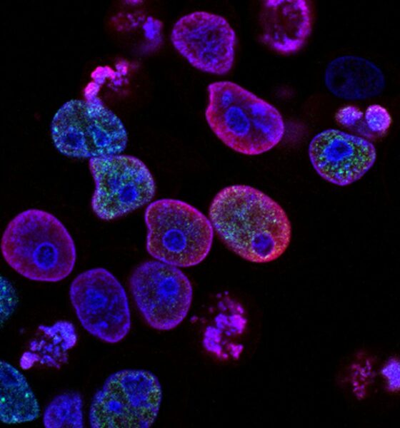 PRISM2 model uses clinical dialogue to interpret pathology slides