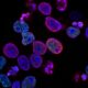 PRISM2 model uses clinical dialogue to interpret pathology slides