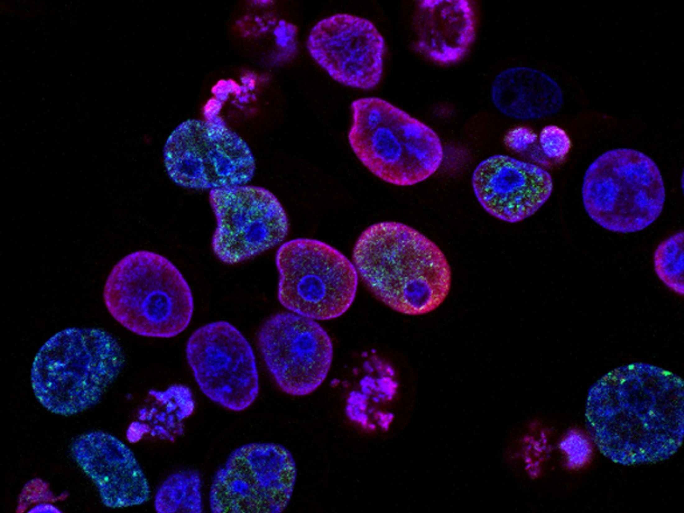 PRISM2 model uses clinical dialogue to interpret pathology slides