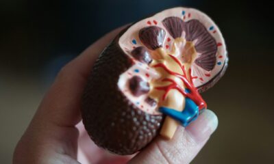 Glasgow-based Mironid raises €39.9 million in Series B to advance rare kidney disease treatment